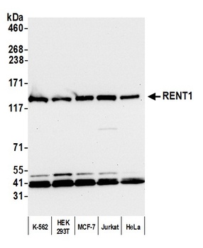 Rabbit RENT1 Antibody