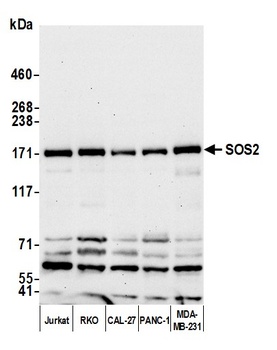 Rabbit SOS2 Antibody