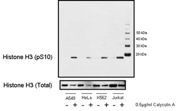 Rabbit Phospho Histone H3 (S10) Antibody