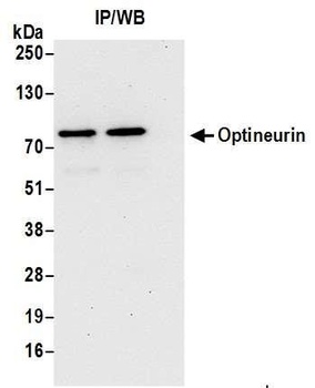 Rabbit Optineurin Antibody