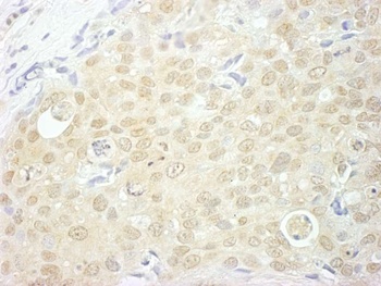 Rabbit NCBP1/CBP80 Antibody