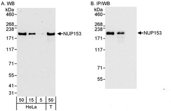 Rabbit NUP153 Antibody