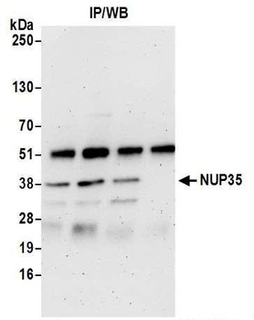 Rabbit NUP35 Antibody