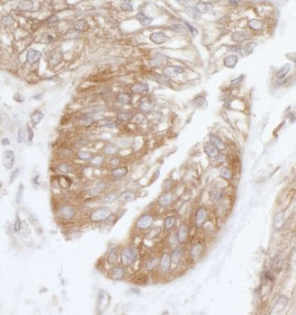 Rabbit eIF3B/EIF3S9 Antibody
