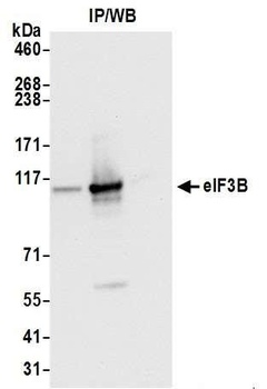 Rabbit eIF3B/EIF3S9 Antibody