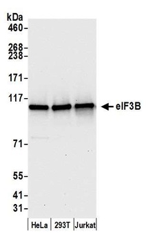 Rabbit eIF3B/EIF3S9 Antibody