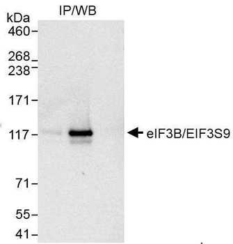 Rabbit eIF3B/EIF3S9 Antibody