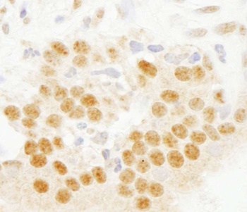 Rabbit SET7 Antibody