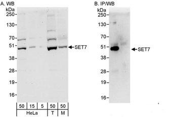 Rabbit SET7 Antibody