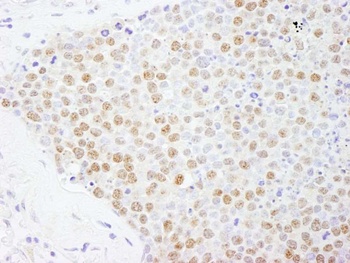Rabbit FOXK2 Antibody
