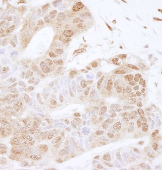 Rabbit FOXK2 Antibody