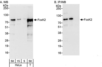 Rabbit FOXK2 Antibody