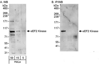 Rabbit eEF2 Kinase Antibody