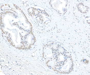 Rabbit EHMT1 Antibody