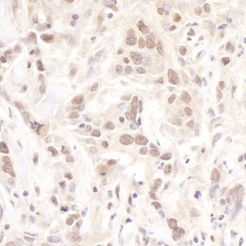 Rabbit Pol Lambda Antibody
