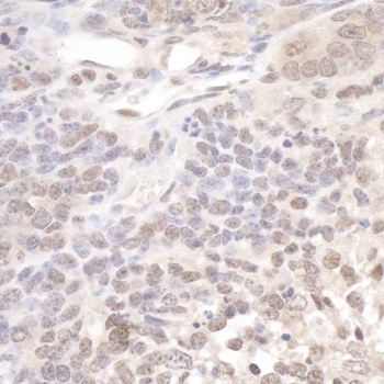 Rabbit Pol Lambda Antibody