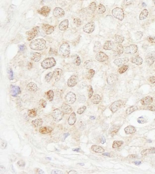 Rabbit MBD4 Antibody