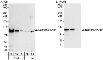 Rabbit NUFIP2/82-FIP Antibody