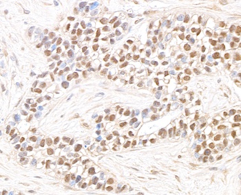 Rabbit JHDM1A Antibody