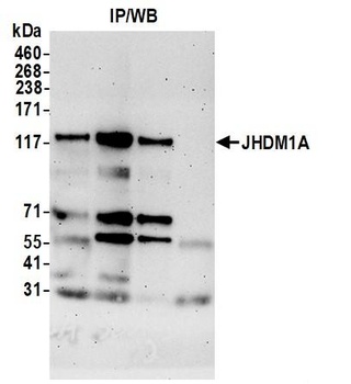 Rabbit JHDM1A Antibody
