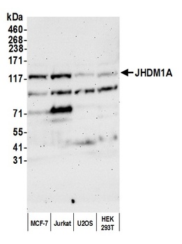 Rabbit JHDM1A Antibody
