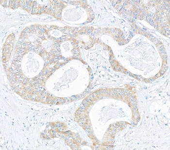 Rabbit CIP2A Antibody