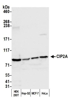 Rabbit CIP2A Antibody