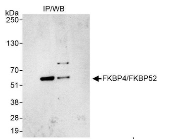 Rabbit FKBP4/FKBP52 Antibody