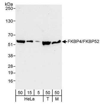Rabbit FKBP4/FKBP52 Antibody