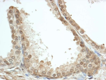 Rabbit FKBP4/FKBP52 Antibody