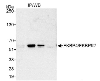 Rabbit FKBP4/FKBP52 Antibody