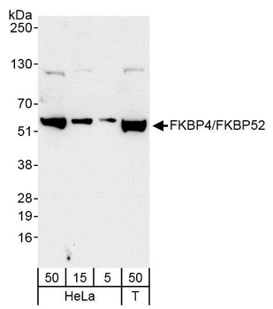 Rabbit FKBP4/FKBP52 Antibody