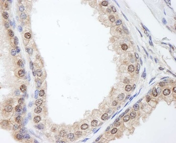Rabbit FKBP4/FKBP52 Antibody