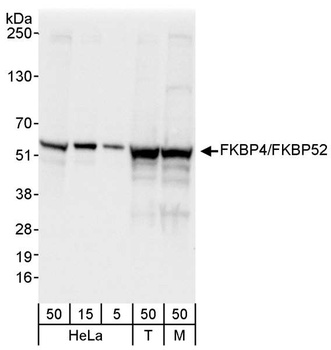 Rabbit FKBP4/FKBP52 Antibody