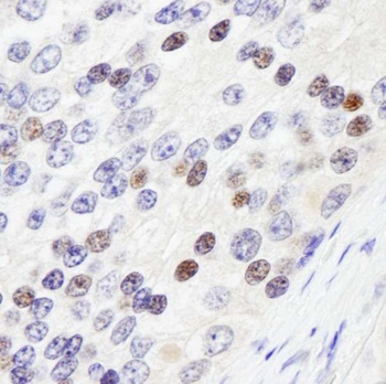 Rabbit ZHX3 Antibody