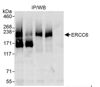 Rabbit CSB/ERCC6 Antibody
