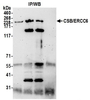 Rabbit CSB/ERCC6 Antibody