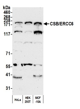 Rabbit CSB/ERCC6 Antibody