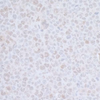 Rabbit CDC20 Antibody