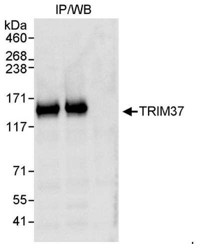 Rabbit TRIM37 Antibody