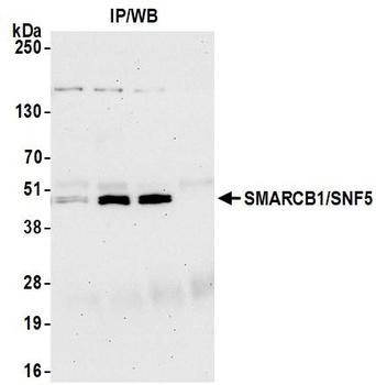 Rabbit SMARCB1/SNF5 Antibody