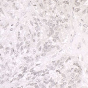 Rabbit SMARCA1/SNF2L Antibody