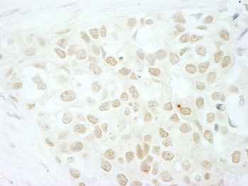 Rabbit MKRN2 Antibody