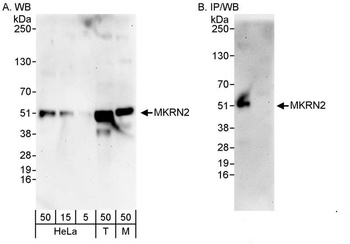 Rabbit MKRN2 Antibody