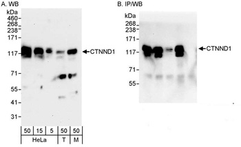 Rabbit CTNND1 Antibody