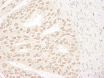Rabbit ANKRD28/PITK Antibody
