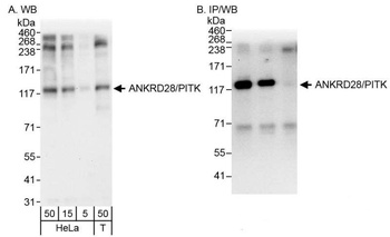 Rabbit ANKRD28/PITK Antibody