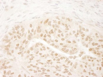 Rabbit DOT1L Antibody