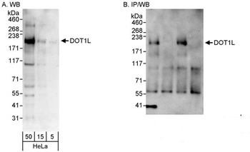 Rabbit DOT1L Antibody