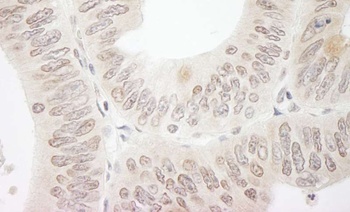 Rabbit DTL/CDT2 Antibody